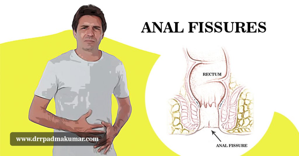 Anal treatment by men Anal treatment by men