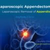 Laparoscopic Appendectomy is the laparoscopic removal of the appendix. Removing Appendix laparoscopically ensures faster recovery, minimal pain, less hospital stay, and faster return to work.