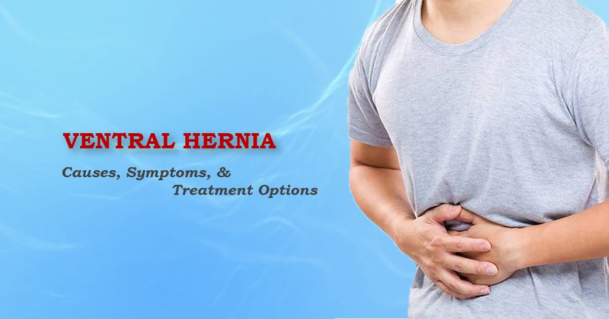 Ventral Hernia Kochi