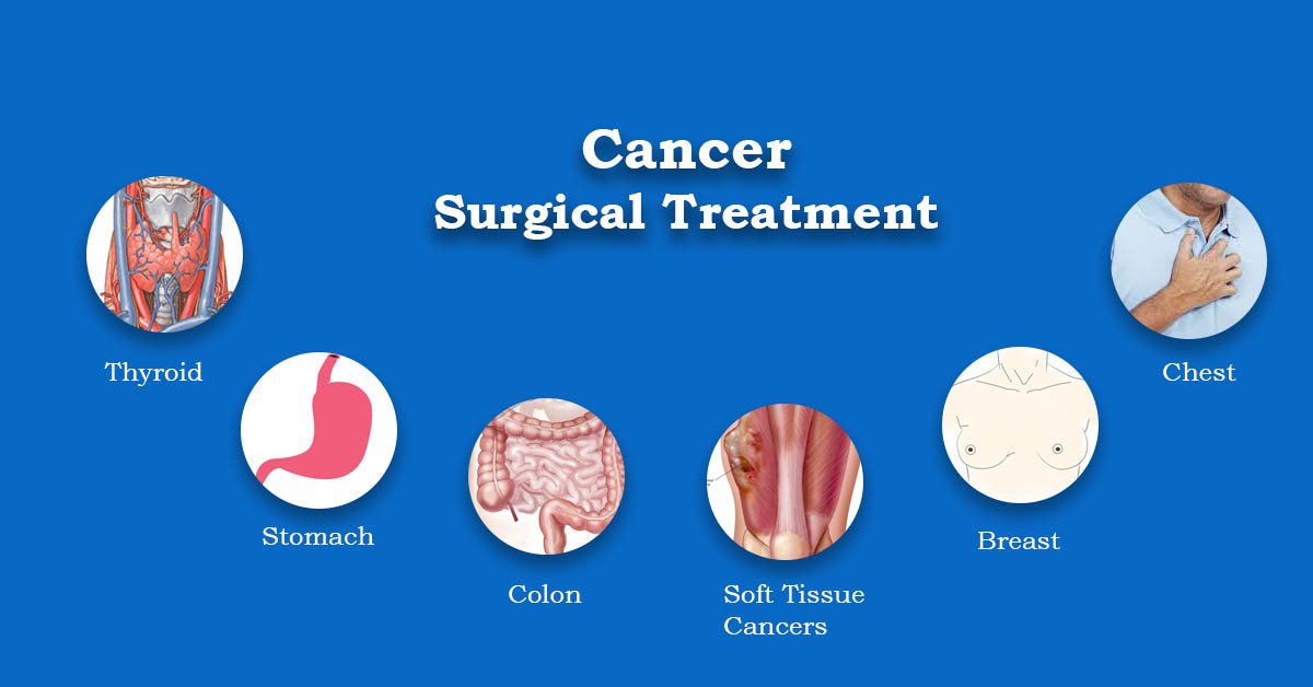Cancer Surgical Treatment in Kochi