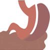 Laparoscopic Sleeve Gastrectomy