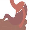 Roux-en-Y Gastric Bypass