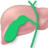 Gallbladder Surgery