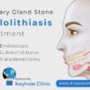 Salivary Gland Stone Treatment - Sialolithiasis Treatment - Endoscopic Submandibular Sialadenectomy